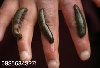 پرورش زالو Breeding leeches