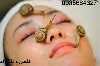 حلزون درمانی صورت