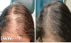 درمان ریزش مو با روغن زیتون