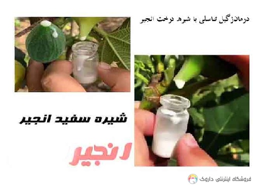 شیره سفید درخت انجیر