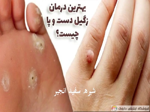 شیره سفید درخت انجیر